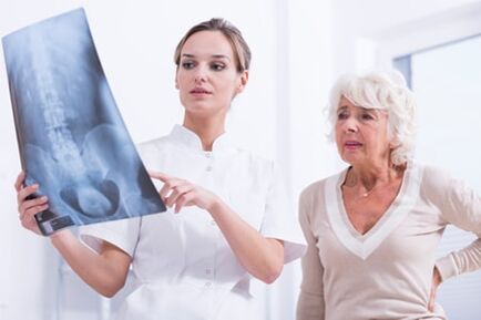 Lekár ukazuje pacientovi X -Ray obrázok chrbtice