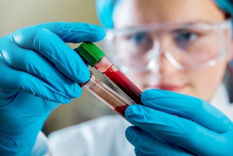 krvný test na diagnostiku príčiny bolesti dolnej časti chrbta
