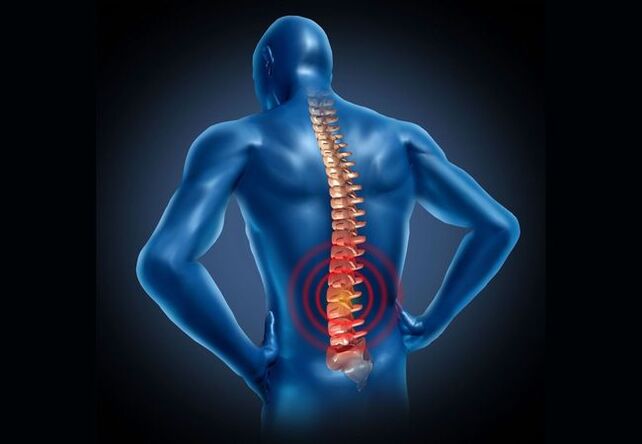 Osteochondróza bedrovej chrbtice je ochorenie, ktoré sa vyskytuje u väčšiny ľudí