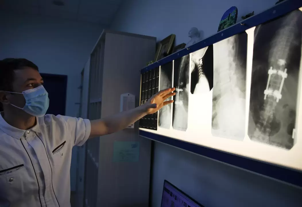 Lekári diagnostikujú cervikálnu osteochondrózu pomocou inštrumentálnych metód, ako je rádiografia