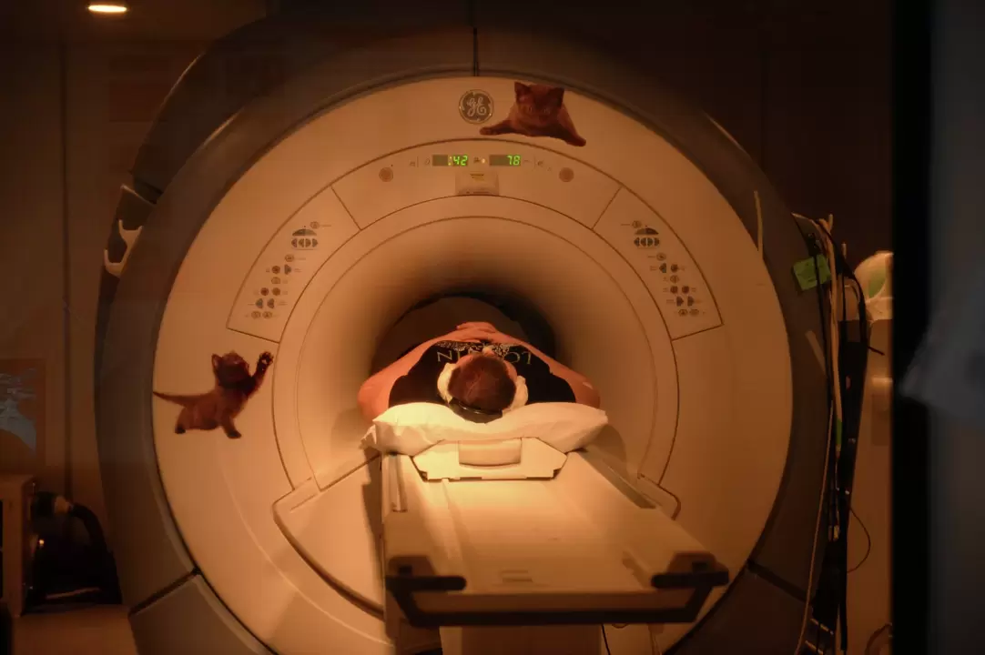 Zobrazovanie magnetickou rezonanciou je najúčinnejšou metódou diagnostiky cervikálnej osteochondrózy